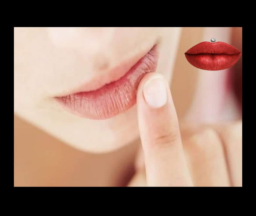 What Are The Dry Lips Causes And How To Care For Lips Healthy Life