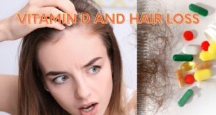 Vitamin D and Hair Loss healthy life for all